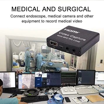 BigPlayer HDMI to USB 2.0 Video Capture Board Game Record Live Streaming Broadcast Local Loop Output (Open-Box)
